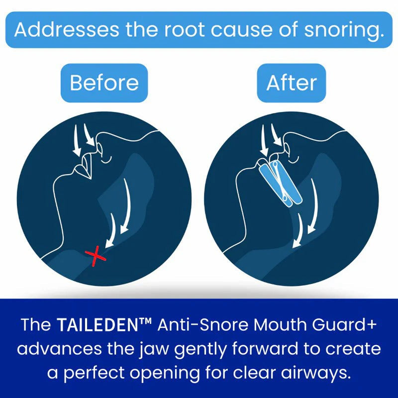 Anti-Snore Mouth Guard+