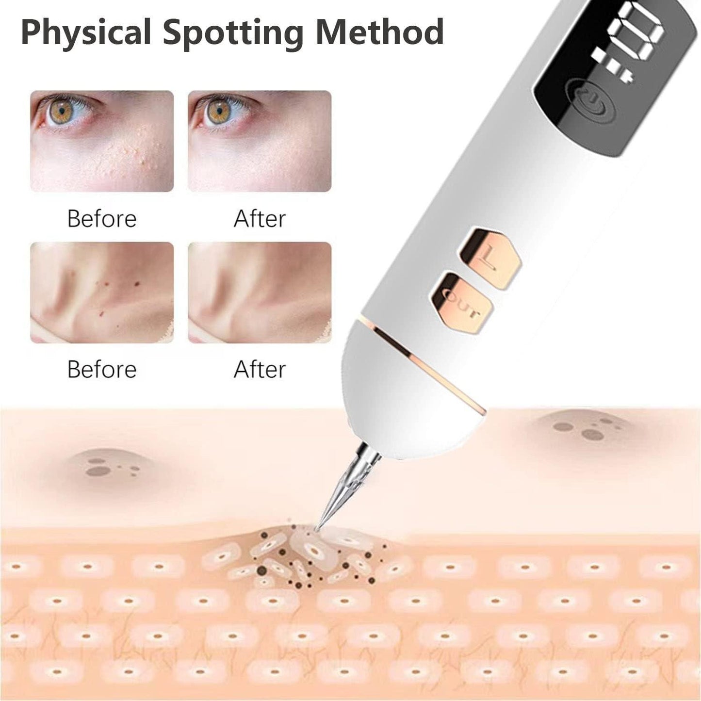 LCD Beauty Pen - Rejuvenating Facial Massager with