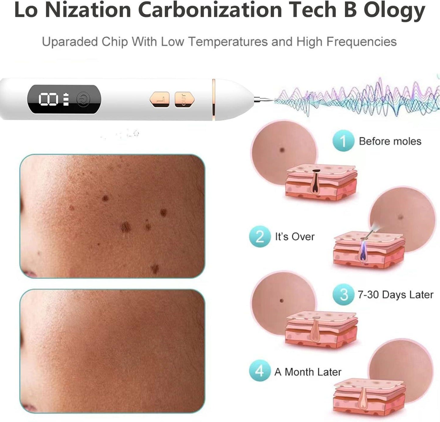 LCD Beauty Pen - Rejuvenating Facial Massager with