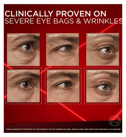 NEW Revitalift Laser Eye Bag Eraser – Instant Gel-to-Tape Formula for Puffy Eyes & Wrinkles (Up to 8H)